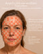 RAYNOVA  | Pro LED Light Therapy Mask + ICE Touch